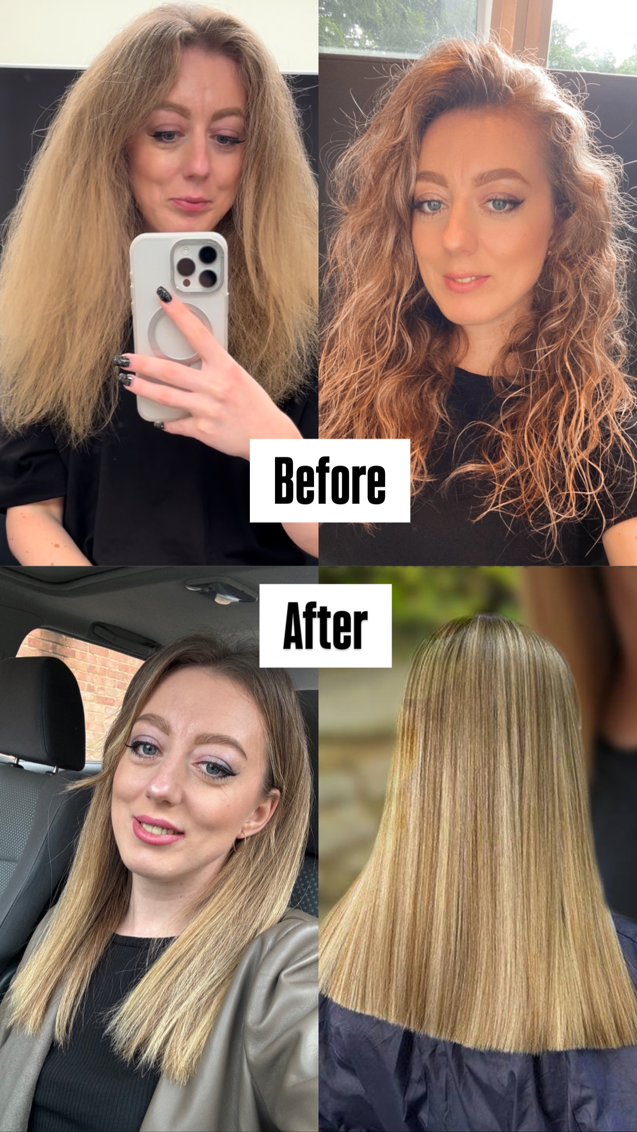 Deep hair restoration result